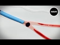 This tiny device spins blood clots away
