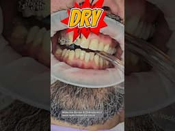 Brace Fitting Appointment