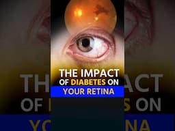 How Diabetes Impacts Your Retina