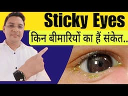 Sticky Eyes ( आँख से कीचड़ आना ) कारण और उपचार || How to treat sticky eyes.