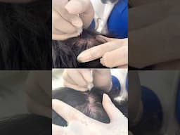 Full MSP Session for Density Effect Revealed – Check the Description! #vincihairclinic #shorts