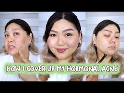 MY ACNE MAKEUP ROUTINE (HOW I COVER MY HORMONAL ACNE) | Bing Castro