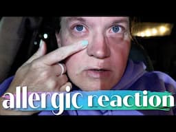 ALLERGIC REACTION LATE AT NIGHT | SPEND THE DAY WITH ME | TRADER JOES FLOWERS & HAUL