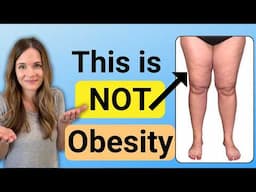 Lipedema. Is it Fat or Swelling?