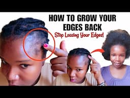 REGROW YOUR EDGES BACK FAST! Fix Balding & Thinning Edges Naturally