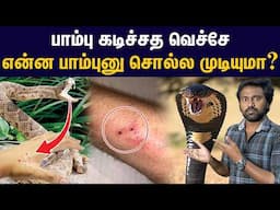 இந்த பாம்பு எல்லாம் கடிச்சா... | Snake rescue documentary