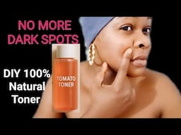 Your Skin Will Thank You - 100% Natural Toner Spot Corrector