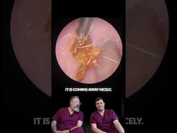 It Looked Soft… But This Ear Wax Plug Was Solid! 👂😳