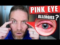 Can Allergies Really Give You Pink Eye? (Allergic Conjunctivits)