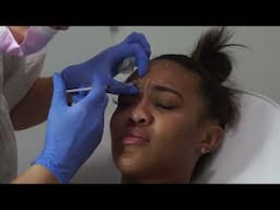 ✨ Black Girl Tries Botox + Filler for the First Time | Honest Experience + Before & After ✨