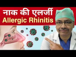 Allergic Rhinitis - naak ki Allergy | बार बार छीक आना । Dr. Ajay Jain