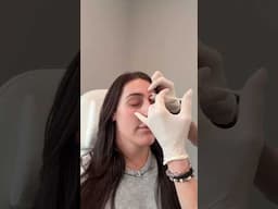 Come with me Botox & Lip Filler Maintenance Day!