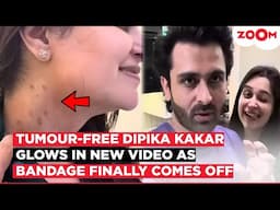 Dipika Kakar GLOWS in video post surgery; Shoaib Ibrahim shows gratitude as treatment continues
