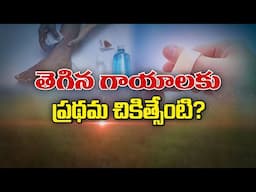 తెగిన గాయాలకు ప్రథమ చికిత్సేంటి? | First aid for Cuts and Wounds  | Sukhibhava | 14th June 2025 | AP