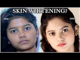 SKIN WHITENING Tips That Actually Work | Glow NATURALLY |🪻🤍🍂 Anchal Shukla |