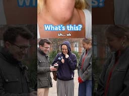 Doctor explains Goitre … #shorts