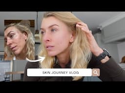 How I Am Clearing My Adult Acne | Skin Journey Vlog