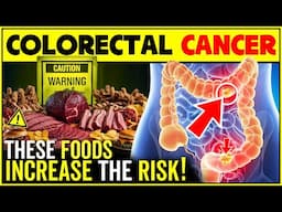Colorectal Cancer: These Foods Increase The Risk Of Colon Cancer
