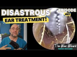DISASTROUS EAR TREATMENT! Episode 463