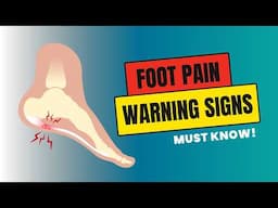 9 Warning Signs of Plantar Fasciitis You Must Know