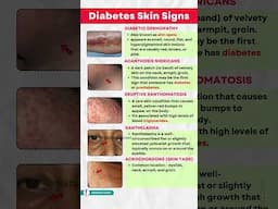 Diabetes Expert Warns 5 Skin Changes You Should NEVER Ignore