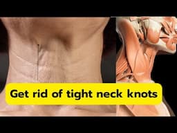 How to get rid of tight neck knots