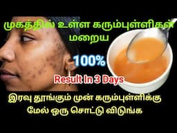 இரவில் தூங்கும் முன் இரண்டு சொட்டு விடுங்க 3நாள்ல marks போகிடும் / remove pimple marks in tamil