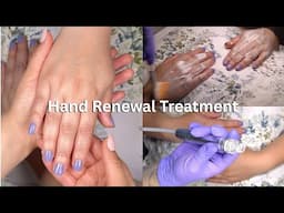 HAND RENEWAL TREATMENT FEAT. ZEMITS VERSTAND HD HYDRODERMABRASION SYSTEM | LICENSED ESTHETICIAN