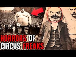 20 Circus Freaks That Actually Existed! Historical Photos
