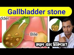 গলব্লাডারের মধ্যে পাথর হলে কি করবেন ।Bengali health 101 is live