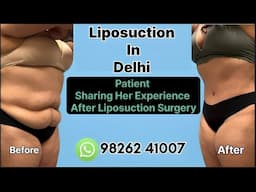Liposuction in Delhi | Best Clinic to Reduce belly fat & lose weight in Delhi | Zenith Clinic