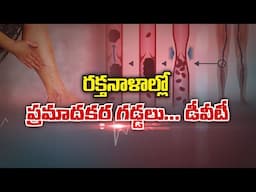 రక్తనాళాల్లో ప్రమాదకర గడ్డలు... డీవీటీ  About Deep Vein Thrombosis Sukhibhava |14th June 2025 ETV AP