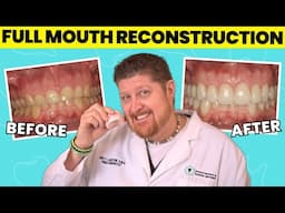 What REALLY Happens in a Full Mouth Reconstruction | Dr. Brett Langston