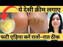 फटी एड़ियां ठीक करने का परमानेंट घरेलु तरीका | Home Remedy To Cure Crack Heels