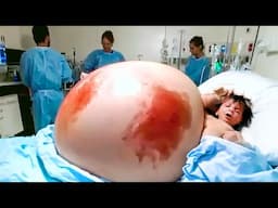 8 Most Unusual Pregnancy Conditions In The World
