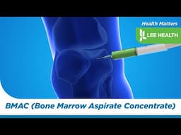 BMAC (Bone Marrow Aspirate Concentrate)