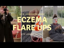 DO YOU HAVE ECZEMA? YOU NEED TO WATCH How I Manage/Prevent Flare Ups | Family Day At The Ritz London