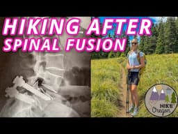 I Had Spinal Fusion Surgery, Now I’m Hiking 14 Miles Again | 1 Year Post Op From PLIF