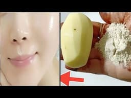 ফেসিয়াল এর চেয়ে ১০গুন গ্লো একদিনে ত্বকের কালো দাগ ময়লা তুলে ত্বক দুধের মত ফর্সা হবে/Besan Facepack