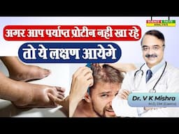 अगर आप पर्याप्त प्रोटीन नहीं खा रहे तो ये लक्षण आयेगे || SIGNS YOU ARE NOT GETTING ENOUGH PROTEIN