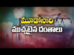 మూడోసారి ముచ్చటైన దంతాలు | About Dental Implants  | Sukhibhava | ETV Life