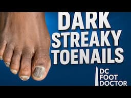 Dark Streaky Toenails