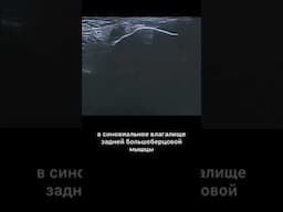 #узи #навигация