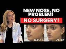 Instant Nose Glow-Up Without Surgery? Watch This Liquid Nose Job Transformation!
