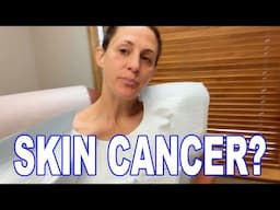 SKIN CANCER CHECK