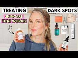 HOW TO FADE DARK SPOTS QUICKLY - BEST SERUMS & TREATMENTS THAT REALLY WORK!