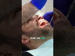 The Importance of Denture Check-ups