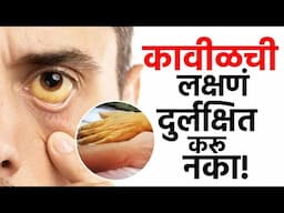 कावीळच्या लक्षणांकडे करू नका दुर्लक्ष! घ्या योग्य खबरदारी | Jaundice Symptoms | AM3