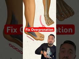 Overpronation Fixes (short & long-term)