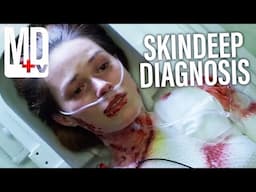 From Nerve-Endings to the Skin: Skindeep Diagnosis | House M.D | MD TV